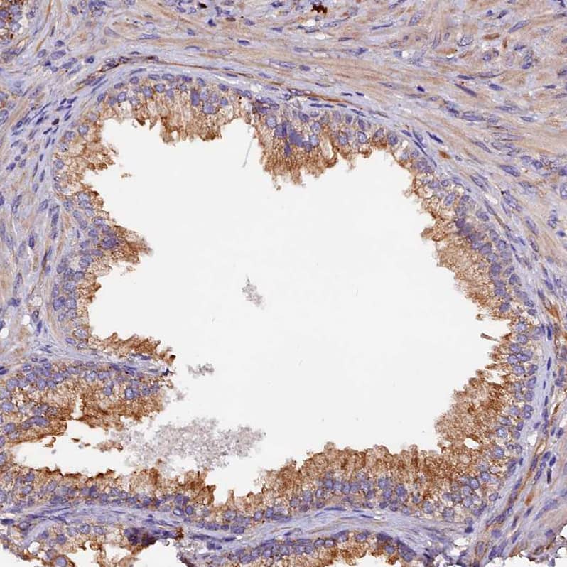 CLN5 Antibody - BSA Free Immunohistochemistry: CLN5 Antibody - BSA Free [NBP1-94150]