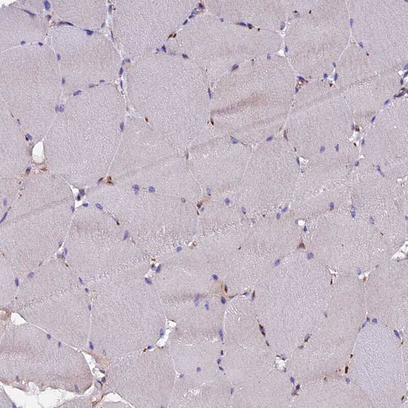 CLN5 Antibody - BSA Free Immunohistochemistry: CLN5 Antibody - BSA Free [NBP1-94150]