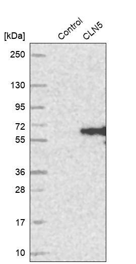 CLN5 Antibody - BSA Free Western Blot: CLN5 Antibody - BSA Free [NBP1-94150]