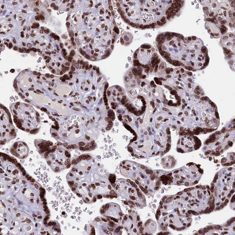 TIMM29 Antibody - BSA Free Immunohistochemistry: TIMM29 Antibody - BSA Free [NBP1-94151]