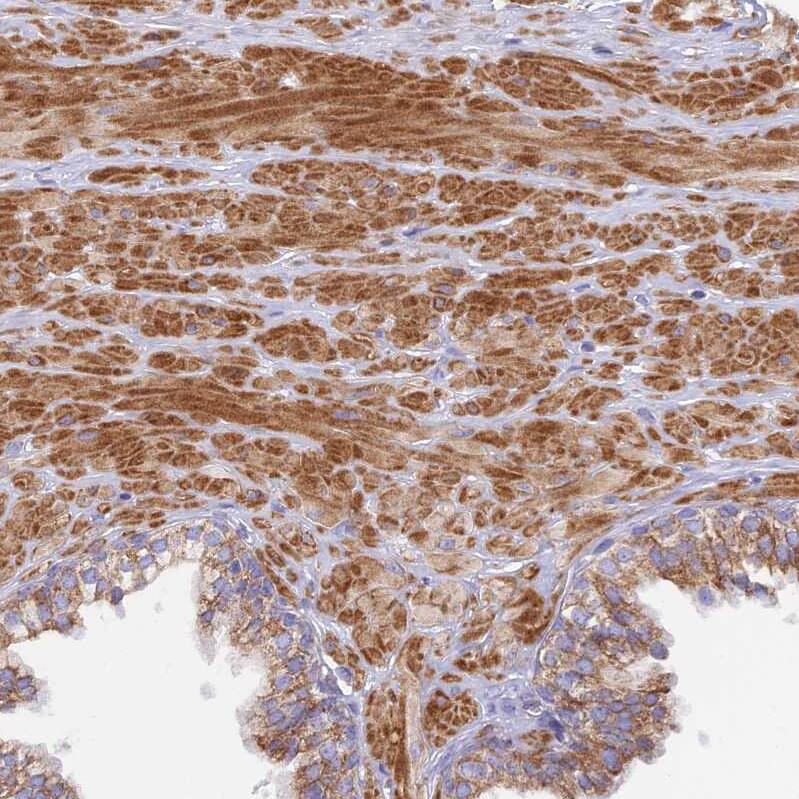 NG2/MCSP Antibody - BSA Free Immunohistochemistry: NG2/MCSP Antibody - BSA Free [NBP1-94154]