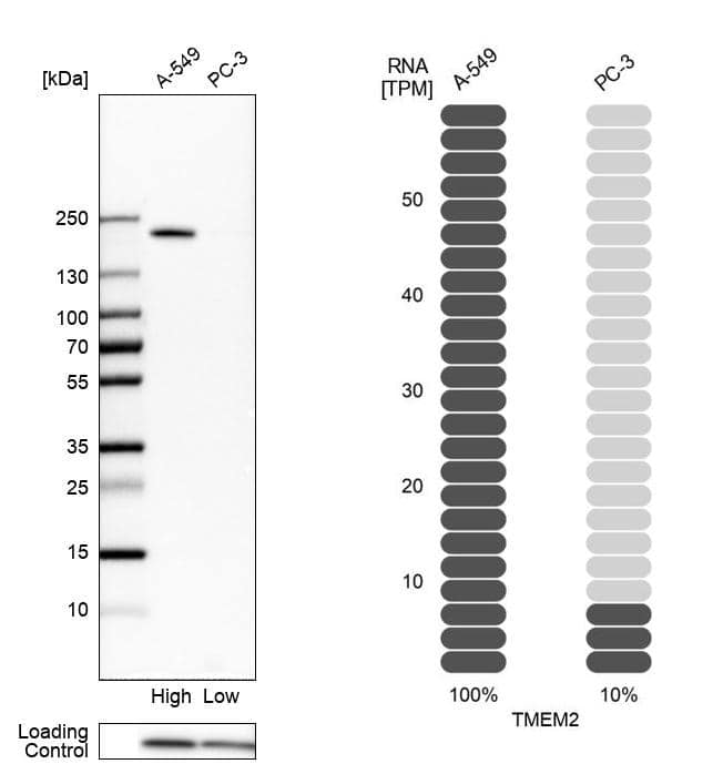TMEM2 Antibody - BSA Free Western Blot: TMEM2 Antibody - BSA Free [NBP1-94168]