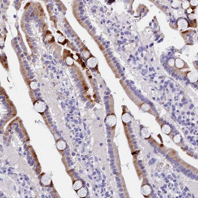MS4A18 Antibody - BSA Free Immunohistochemistry: MS4A18 Antibody - BSA Free [NBP1-94170]