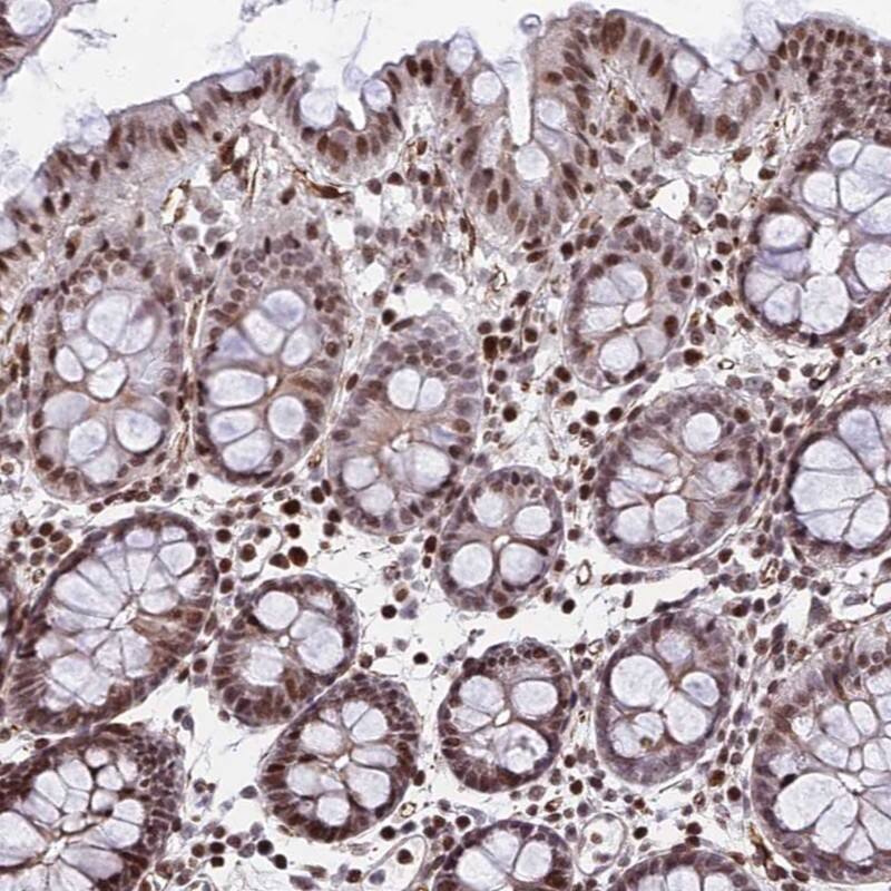 NYAP2 Antibody - BSA Free Immunohistochemistry: NYAP2 Antibody - BSA Free [NBP1-94175]
