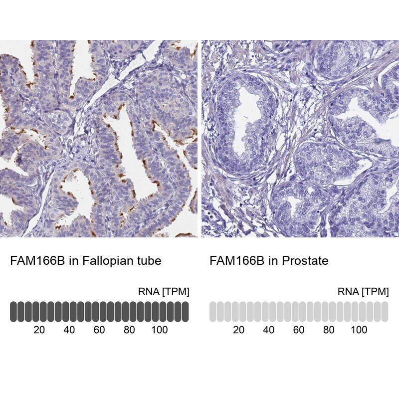 FAM166B Antibody - BSA Free Immunohistochemistry: FAM166B Antibody - BSA Free [NBP1-94176]