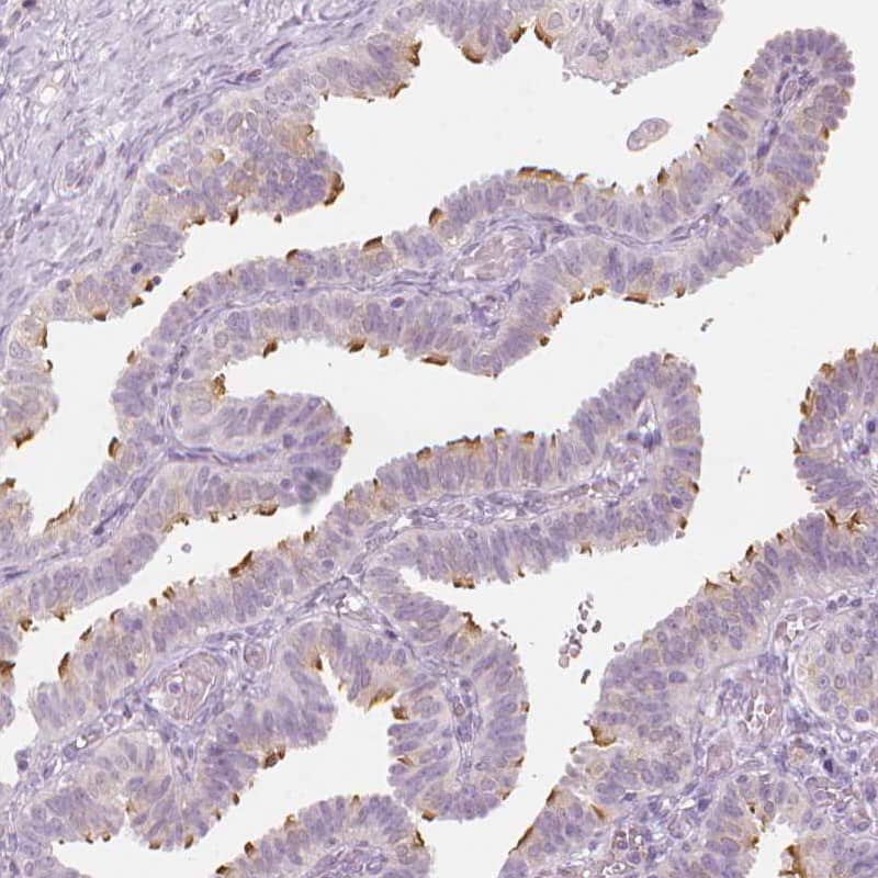CFAP126 Antibody - BSA Free Immunohistochemistry: CFAP126 Antibody - BSA Free [NBP1-94181]