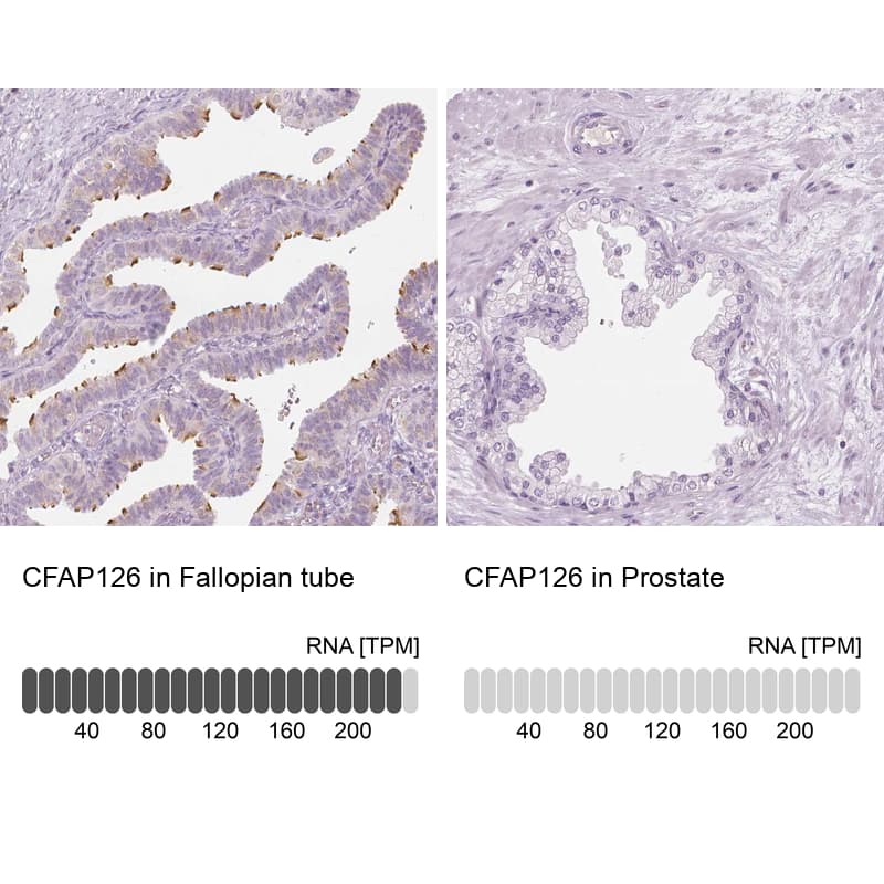 CFAP126 Antibody - BSA Free Immunohistochemistry: CFAP126 Antibody - BSA Free [NBP1-94181]