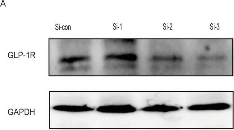 GLP-1R Antibody - BSA Free
