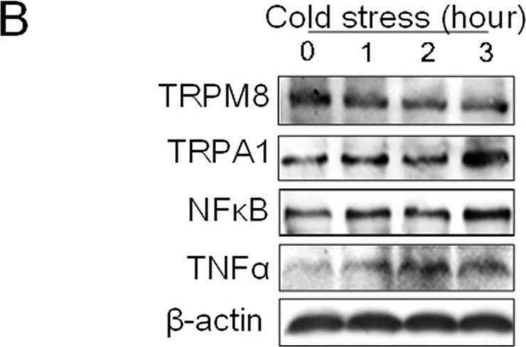 TRPM8 Antibody - BSA Free