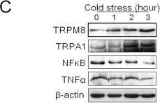 TRPM8 Antibody - BSA Free