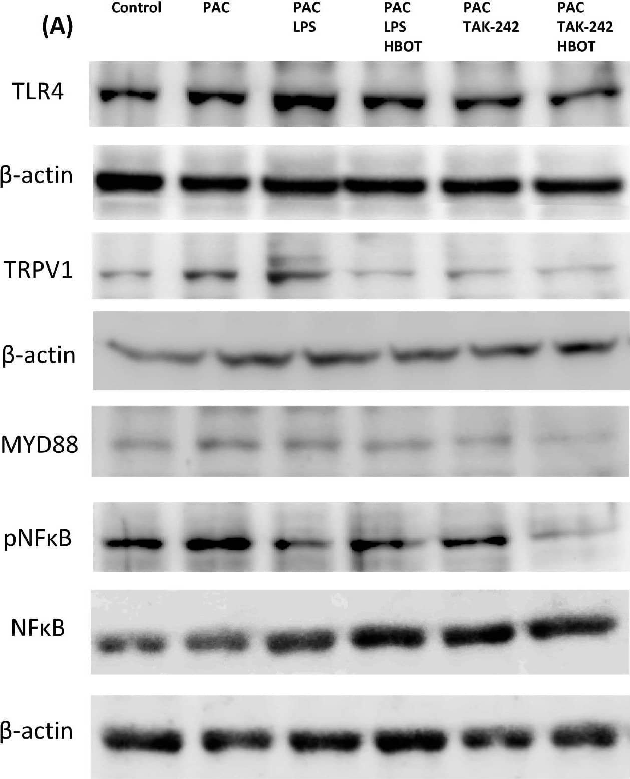 Vanilloid R1/TRPV1 Antibody - BSA Free