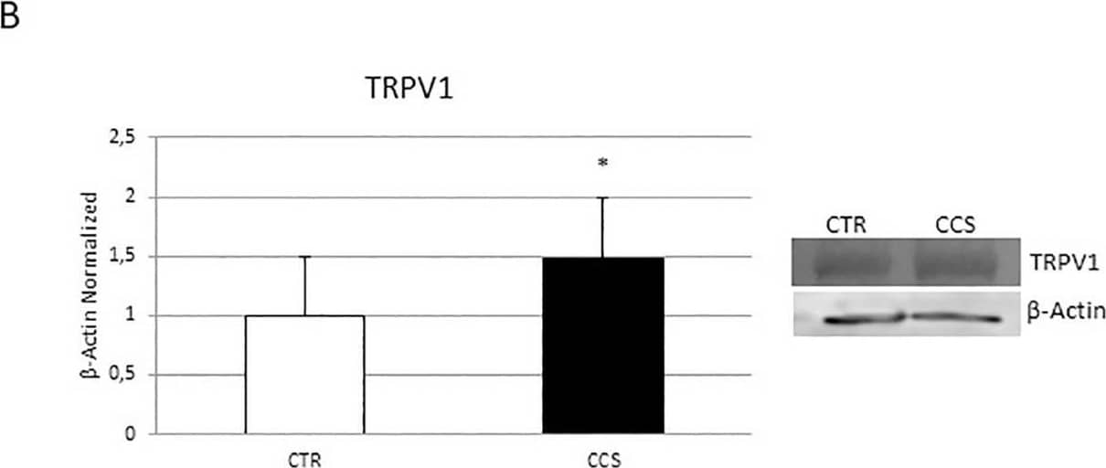 Vanilloid R1/TRPV1 Antibody - BSA Free