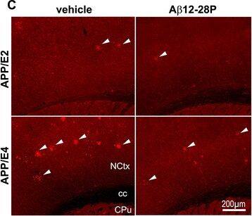 Apolipoprotein E/ApoE Antibody (3D12)