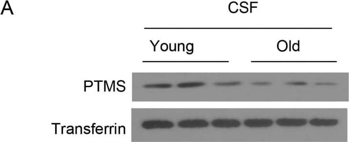 Transferrin Antibody