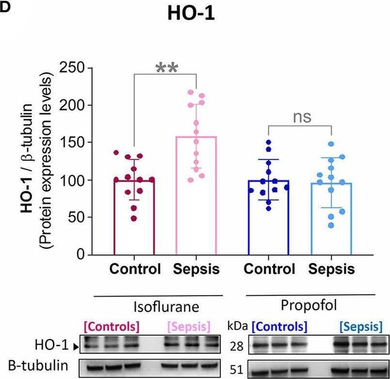 HO-1/HMOX1/HSP32 Antibody (HO-1-1) - BSA Free