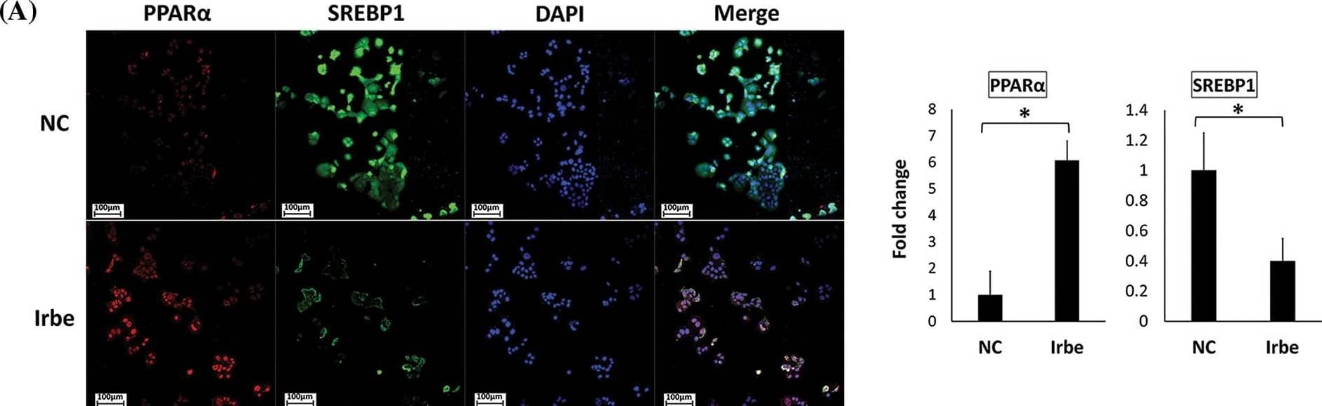 SREBP1 Antibody - BSA Free