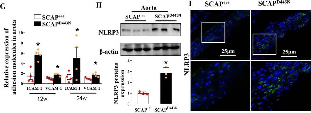 NLRP3/NALP3 Antibody (Nalpy3-b) - BSA Free