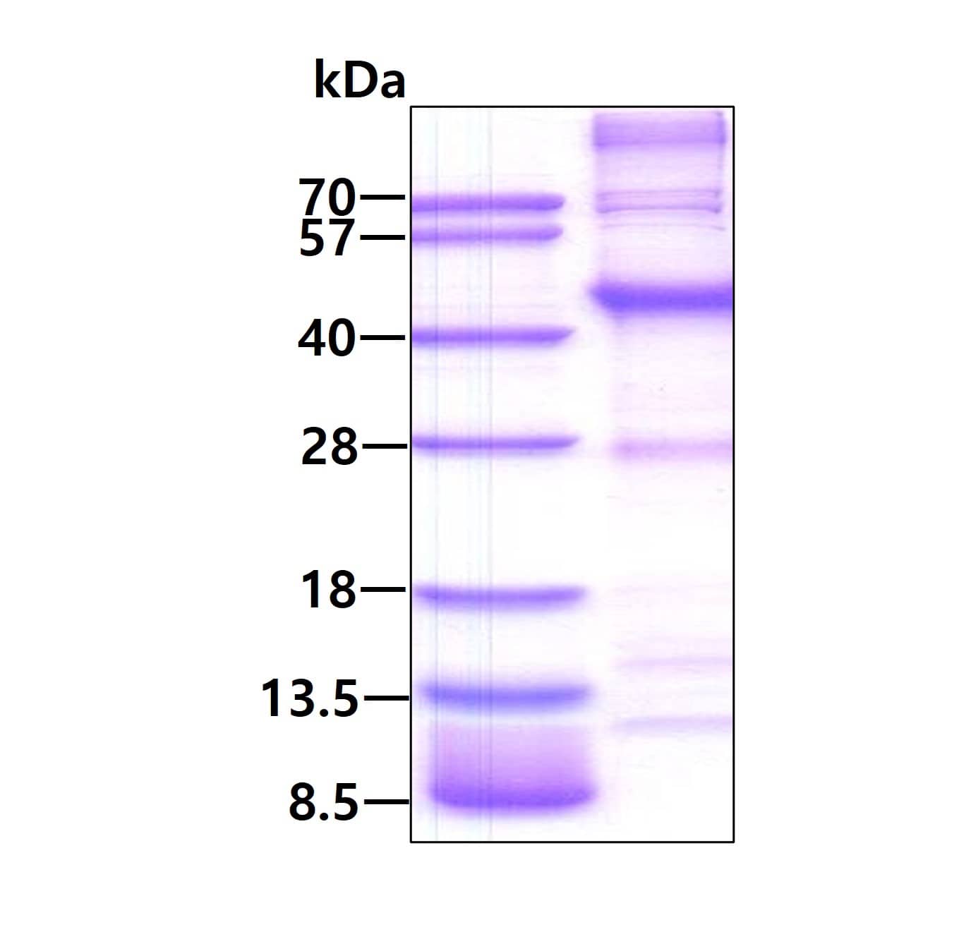 Recombinant Human MAGEA6 His Protein