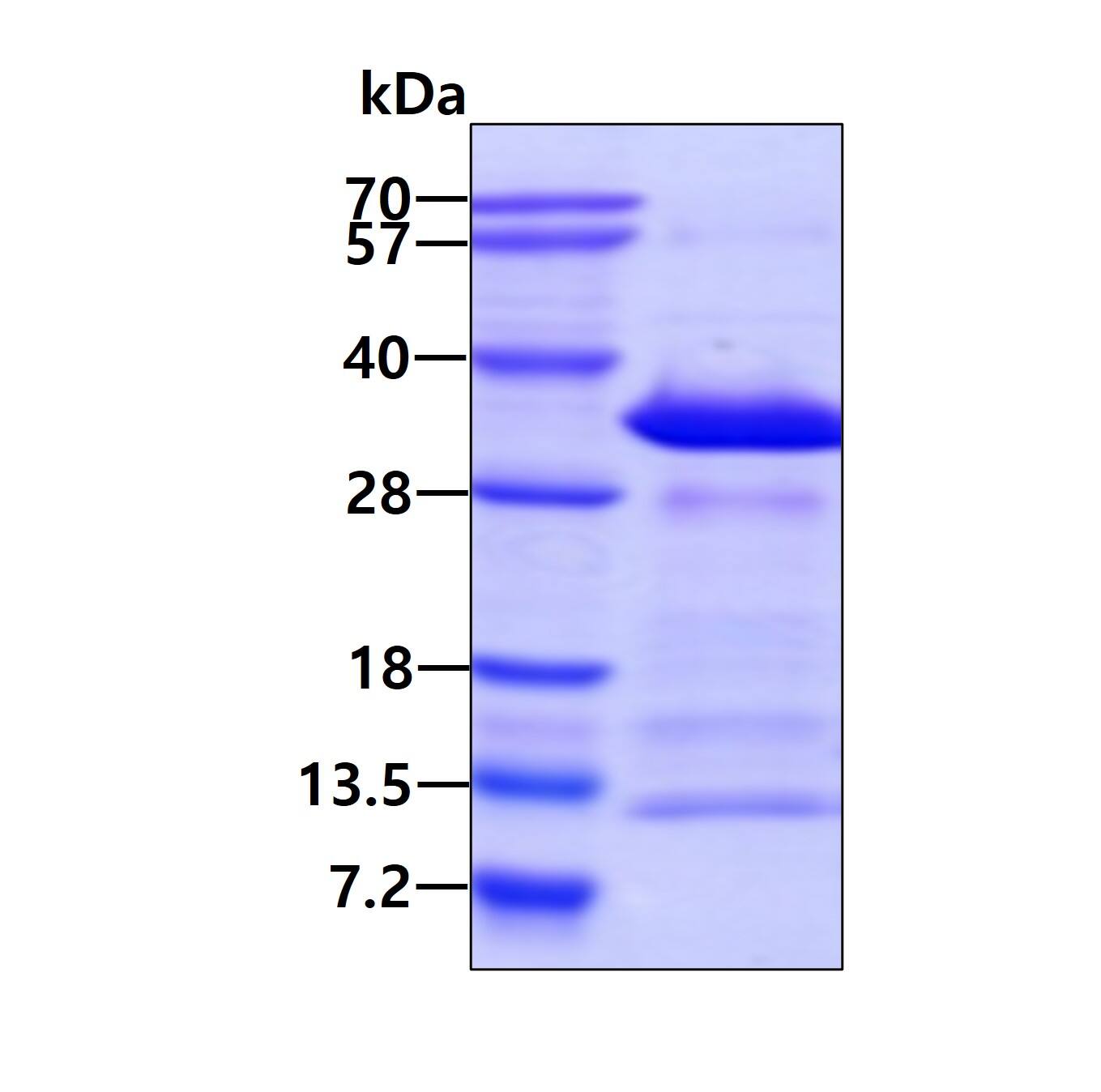 Recombinant Human Syntaxin 12 His Protein