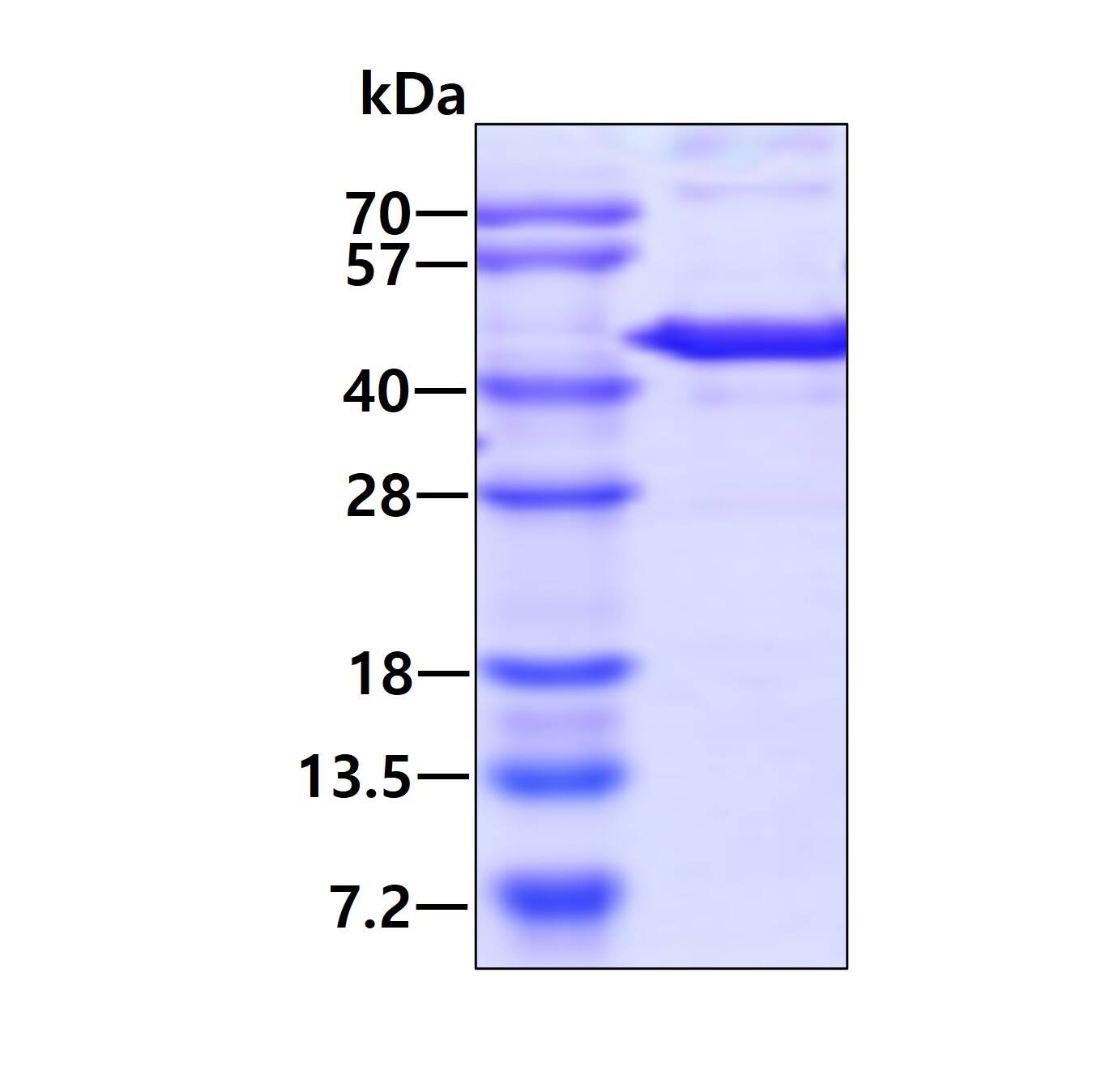 Recombinant Human Methionine Aminopeptidase 1/METAP1 His Protein