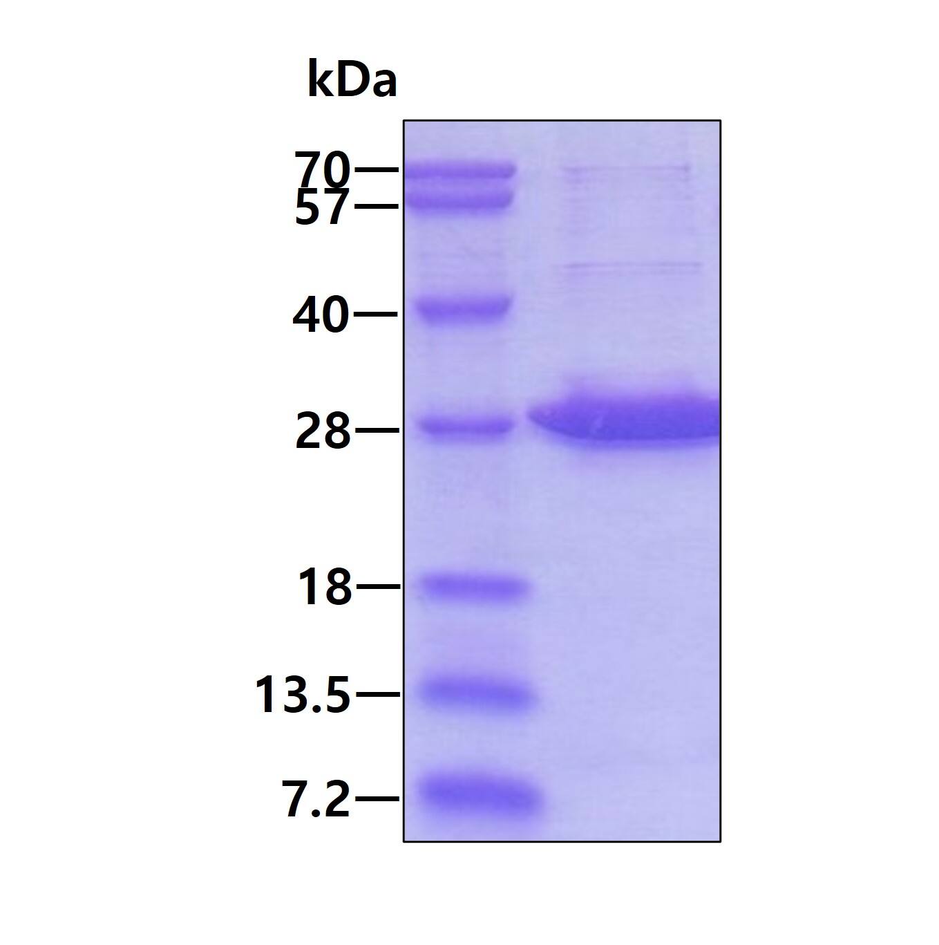 Recombinant Human Exosome component 5 His Protein SDS-Page: Recombinant Human Exosome component 5 Protein [NBP1-99063]