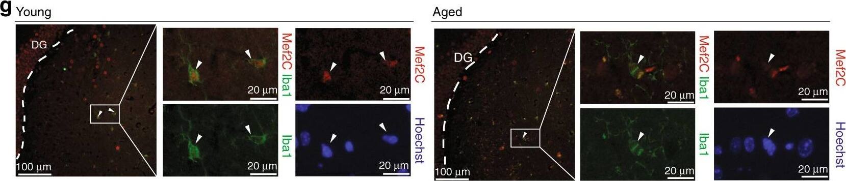 MEF2C Antibody (OTI1H5)