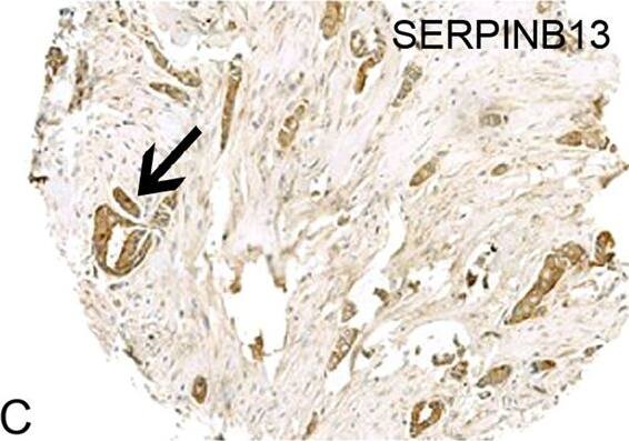 SERPINB13 Antibody (OTI2B6)