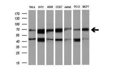 RUNX1T1/ETO Antibody (OTI1H1)