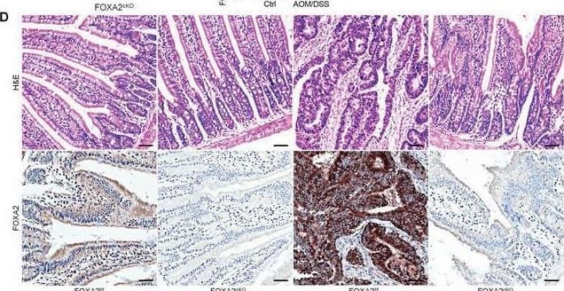 HNF-3 beta/FoxA2 Antibody (OTI3C10)