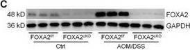 HNF-3 beta/FoxA2 Antibody (OTI3C10)