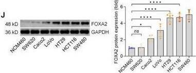 HNF-3 beta/FoxA2 Antibody (OTI3C10)