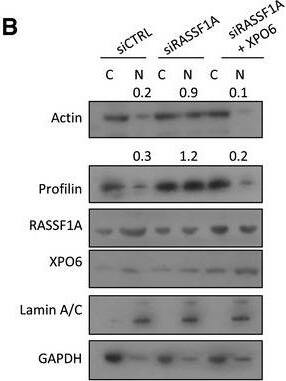 Profilin 1 Antibody (OTI1D5)
