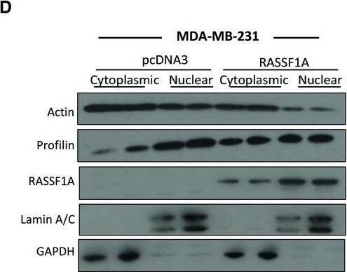 Profilin 1 Antibody (OTI1D5)