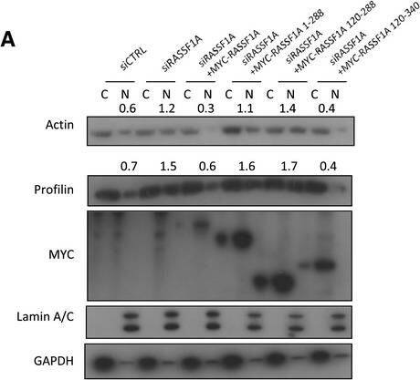 Profilin 1 Antibody (OTI1D5)