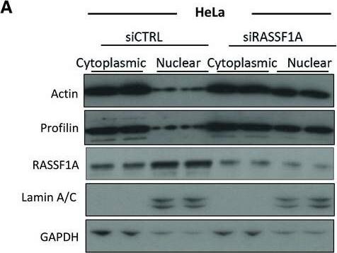Profilin 1 Antibody (OTI1D5)