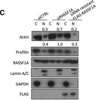 Profilin 1 Antibody (OTI1D5)