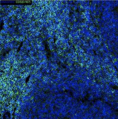CD5 Antibody (OTI7A7)