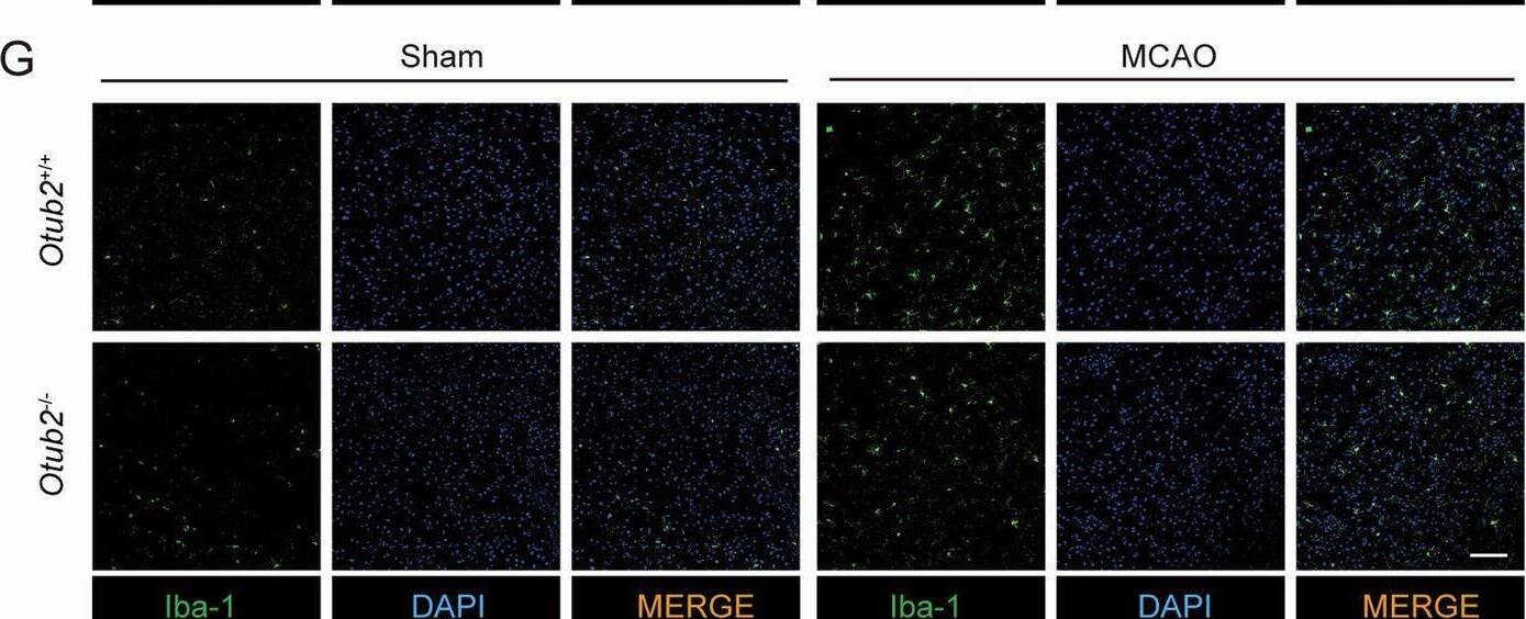 Otubain-2 Antibody (OTI11B3)