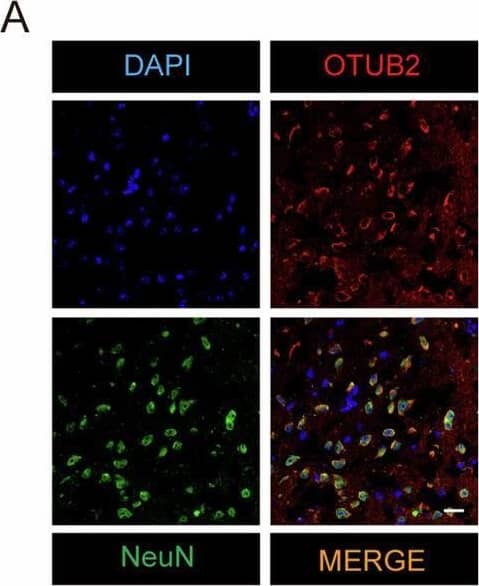 Otubain-2 Antibody (OTI11B3)