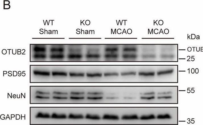 Otubain-2 Antibody (OTI11B3)
