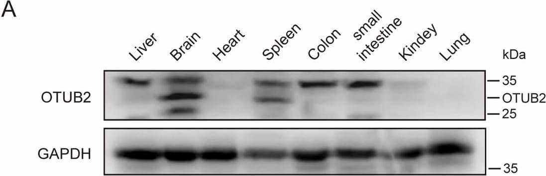 Otubain-2 Antibody (OTI11B3)