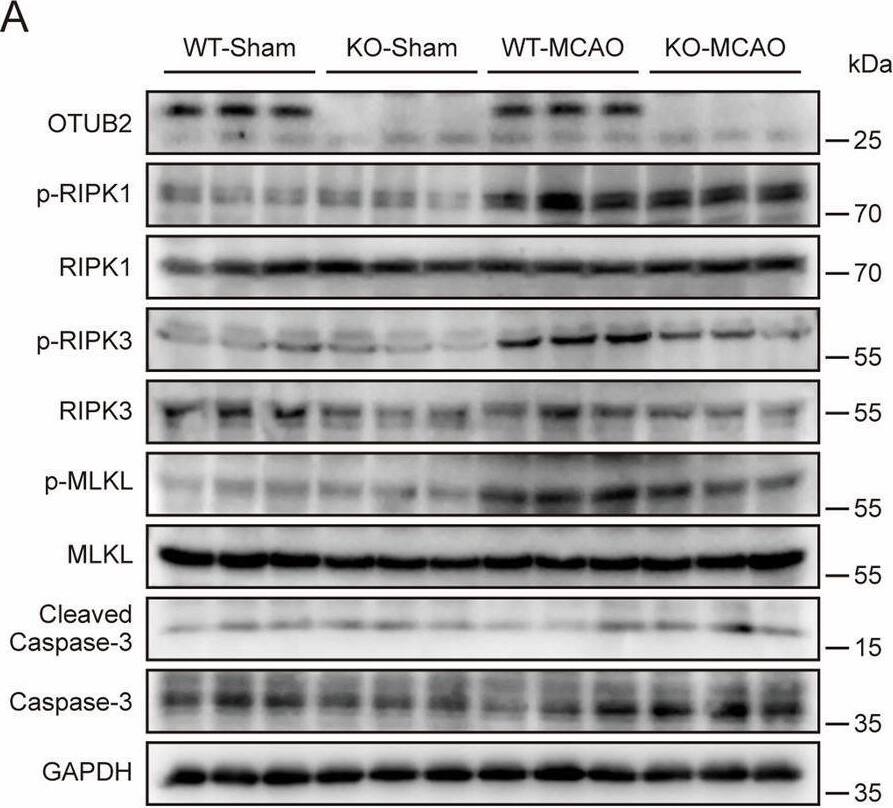 Otubain-2 Antibody (OTI11B3)