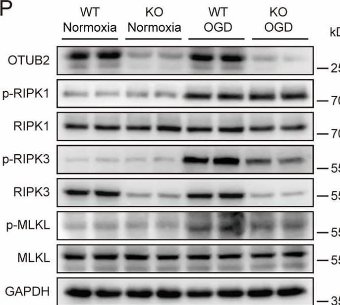 Otubain-2 Antibody (OTI11B3)