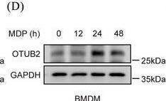 Otubain-2 Antibody (OTI11B3)