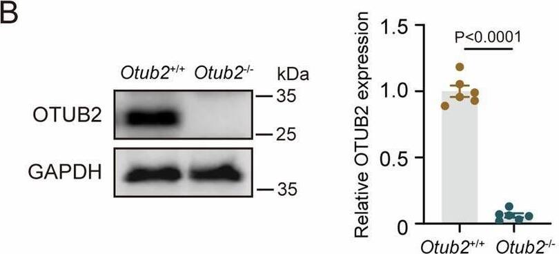 Otubain-2 Antibody (OTI11B3)