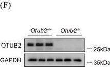 Otubain-2 Antibody (OTI11B3)