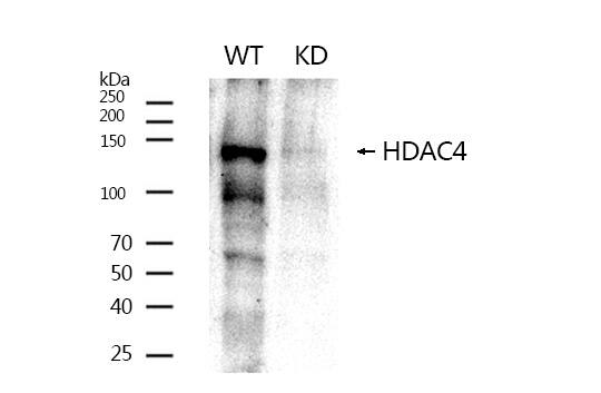 Histone Deacetylase 4/HDAC4 Antibody - BSA Free