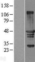 TCP10 Overexpression Lysate