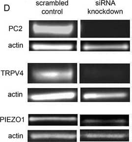 PIEZO1 Antibody