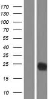 CTLA-4 Overexpression Lysate
